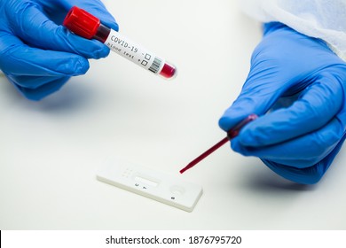 UK lab tech scientist placing blood sample on Rapid Diagnostic Test RDT cassette,medical technician performing quick fast blood PRP testing identifying antibodies for Coronavirus SARS-CoV-2 COVID-19