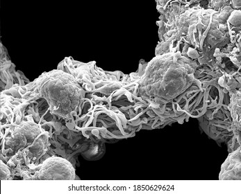 Ultra close-up scanning electron microscopic image of single cells residing on the fibres of the net-like myenteric plexus of a mouse