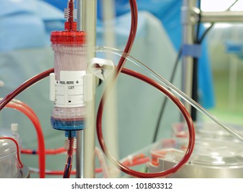 Ultrafiltration During Cardiopulmonary Bypass. Photo.