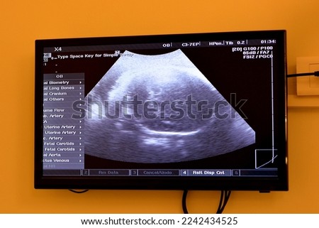 Ultrasonography on the uterus of a pregnant woman showing a healthy fetus, maternal ultrasound during pregnancy, pregnancy follow up and fetus health concept, ultrasonogram medical checkup 