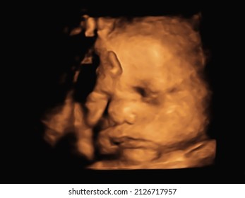 Ultrasound 3D 4D Of Baby In Mother's Womb. 