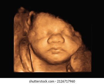 Ultrasound 3D 4D Of Baby In Mother's Womb. 