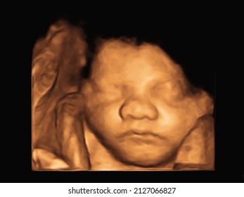 Ultrasound 3D 4D Of Baby In Mother's Womb. 