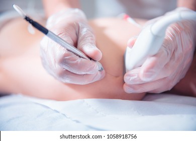 Ultrasound assisted ecography intratissue percutaneous electrolysis dry needling physical therapy rehabilitation physiotherapist treatment machine in hospital medical center IPE physiotherapy clinic.