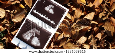 Ultrasound of a baby in the hands of his father