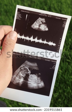 Ultrasound of a child in his father's hands