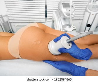 Ultrasound fat cavitation. Fat reduction treatment for woman's leg, and body contouring with cavitation machine