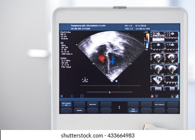 ultrasound of the heart of man