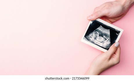 Ultrasound image pregnant baby photo. Woman hands holding ultrasound pregnancy picture on pink background. Pregnancy, medicine, pharmaceutics, health care and people concept - Shutterstock ID 2173346099