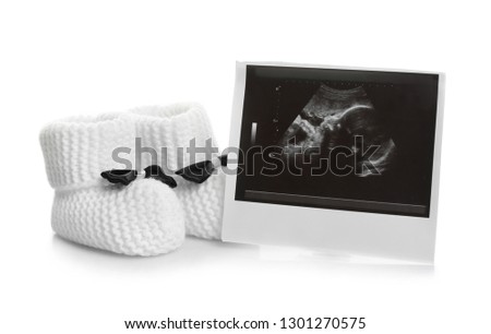 Ultrasound photo and baby shoes on white background. Concept of pregnancy