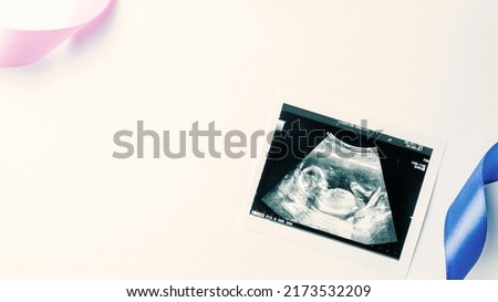 Ultrasound photo pregnancy baby. Blue, pink ribbon with ultrasound pregnancy picture on white background. Concept maternity, pregnancy, childbirth