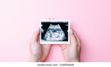 Ultrasound picture pregnant baby photo. Woman hands holding ultrasound pregnancy image on pink background. Concept of pregnancy, maternity, expectation for baby birth - Shutterstock ID 2149030449