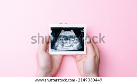 Ultrasound picture pregnant baby photo. Woman hands holding ultrasound pregnancy image on pink background. Concept of pregnancy, maternity, expectation for baby birth