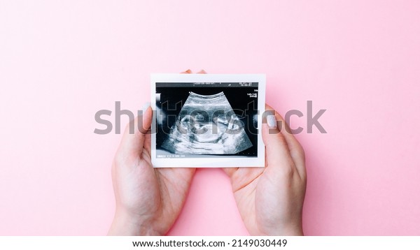Ultrasound picture\
pregnant baby photo. Woman hands holding ultrasound pregnancy image\
on pink background. Concept of pregnancy, maternity, expectation\
for baby birth