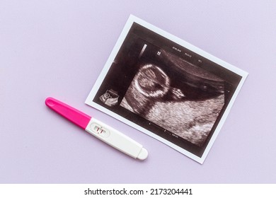 Ultrasound Picture Unborn Baby Positive Pregnancy Stock Photo ...