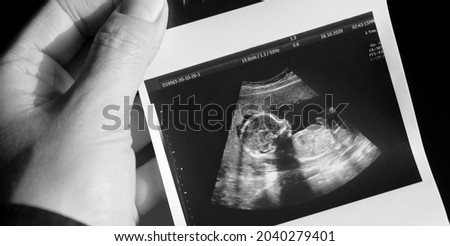 Ultrasound of a pregnant woman who is expecting her baby with a lot of love