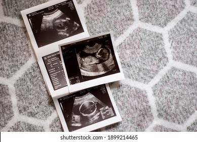 Ultrasound results in the second trimester of pregnancy. Photo of the fetus on a light geometric background. Expectation of the child. Infertility treatment. Artificial insemination. ECO.