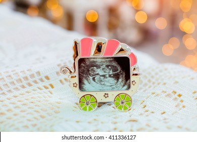 Ultrasound Of Twins In The Womb To The Stroller Frame