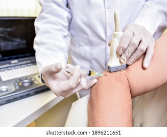 Ultrasound-guided platelet-rich plasma injection of the elbow