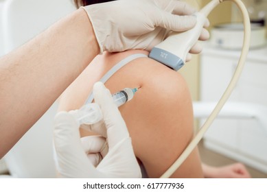 Ultrasound-guided platelet-rich plasma injection of the s
