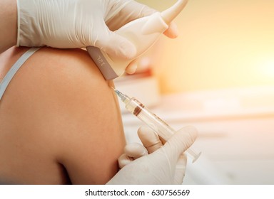 Ultrasound-guided Platelet-rich Plasma Injection Of The Shoulder