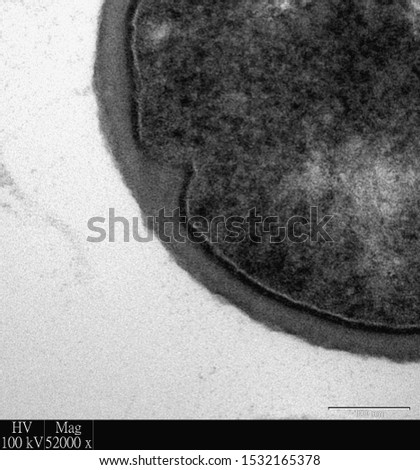 Ultra-structure of Gram Positive Bacteria showing cell wall and cell membrane. Faintly stained outer region is the cell wall and the darkly stained stained inner region is the cell membrane. 