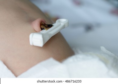 Umbilical Cord With Clamp Of Newborn Baby In Neonatal Intensive Care Unit Close-up