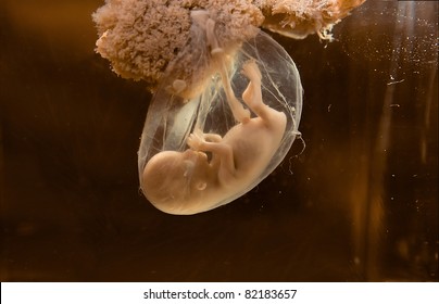 Unborn Human Embryo Model For Education Purpose