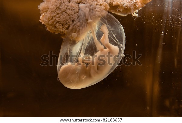 Unborn human\
embryo model for education\
purpose