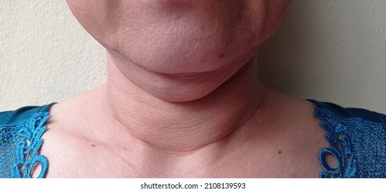 205 Large swollen stomach Images, Stock Photos & Vectors | Shutterstock