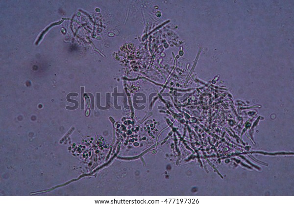 Under Microscope Showing Pseudohypha Budding Patterns Stock Photo ...