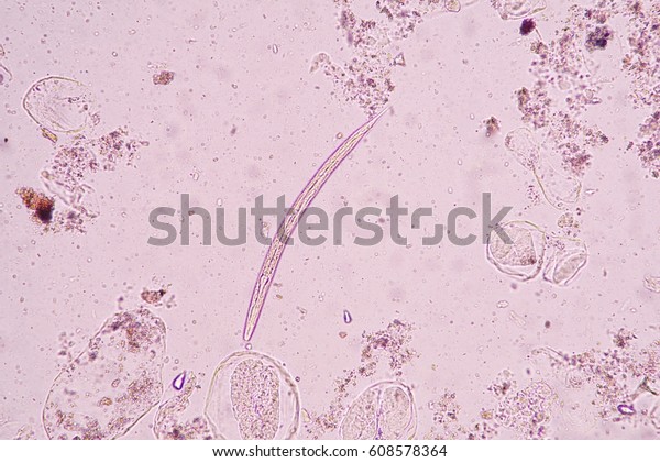 Under Microscopy Showing Strongyloides Stercoralis Larva Stock Photo ...