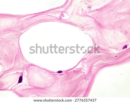 Under an optical microscope, the adipocytes appear as large vacuoles with flattened nuclei located at the cell edge. These are adipocytes from a woman's resting mammary gland. Magnification: 1000×
