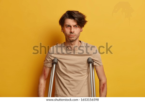 Unhappy man suffers from consequences of car or
motorbike accident, has bruises under eyes and scratches, stuck on
pedestrian crossing by drunk driver stands on crutches indoor needs
treatment