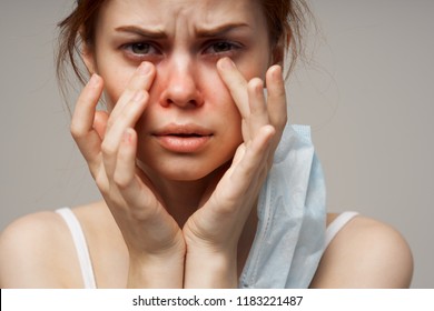 Unhealthy Appearance Of A Woman Red Spots On The Face                        