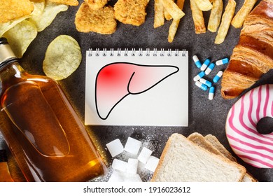 Unhealthy Lifestyle And Habits - Risk Of Liver Damage. Top View