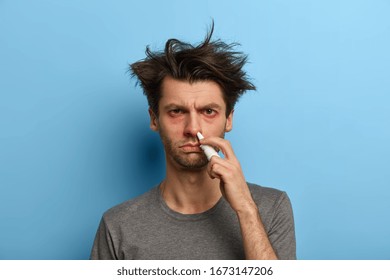 Unhealthy Man Treats Nose With Spray, Suffers From Allergic Rhinitis, Has Watery Red Eyes, First Symptoms Of Virus, No Addictions To Medicals, Isolated Over Blue Background. Sinusitis Treatment