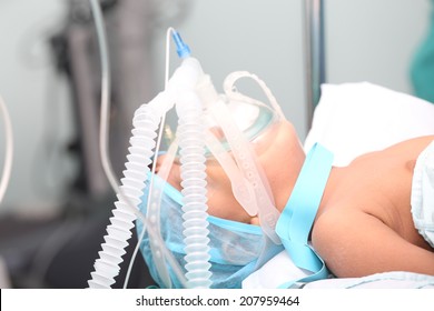 Unidentified Boy With Oxygen Mask In The Surgery. Focus In The Mask Tubes.