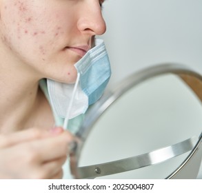 Unknown Woman Having Blemishes And Imperfections After Wearing Protective Medical Mask. Teenage Girl Looking At Mirror And Checking Pimples On Cheek