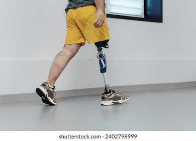 Unrecognisable male in yellow coloured shorts wearing prosthetic leg walking in luminous spacious corridor - Powered by Shutterstock