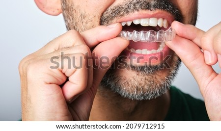 unrecognizable dark-haired man with beard putting on transparent dental retainer