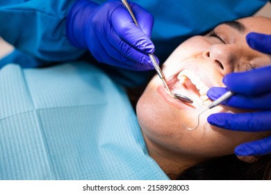 785 Dental excavator Images, Stock Photos & Vectors | Shutterstock