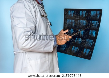 unrecognizable doctor pointing at a person's MRI