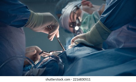 Unrecognizable medic holding instruments while another anonymous medic in mask and glasses performs abdominal surgical procedure in his gloves shot in blue colors and shallow depth of field - Powered by Shutterstock - Get 15% off with code: PIKWIZARD15