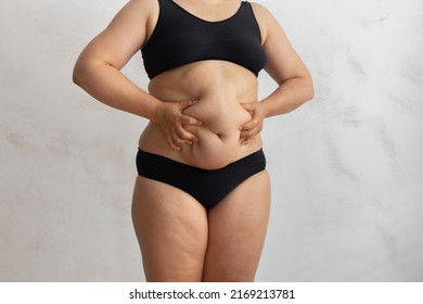 Unrecognizable Overweight Obese Woman In Black Bikini Touching And Squeezing Big Dangling Tummy. Hand Self Massage To Dry Friable Cellulite Skin. Body Care. Food Addiction, Obsession, Overeat Problem