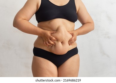 Unrecognizable Overweight Obese Woman In Black Bikini Touching And Squeezing Big Dangling Tummy. Hand Self Massage To Dry Friable Cellulite Skin. Body Care. Food Addiction, Obsession, Overeat Problem