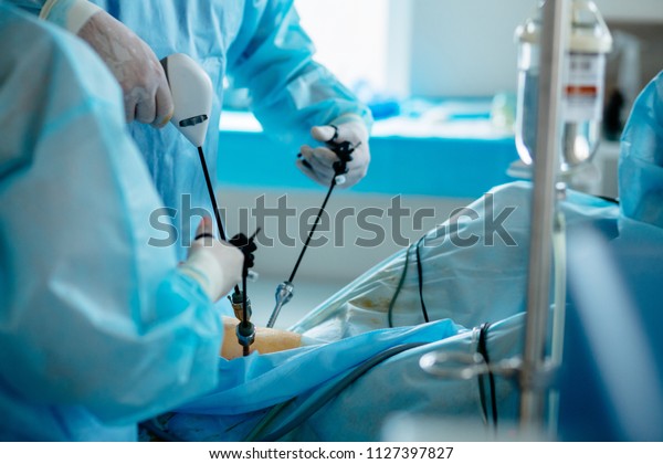 Unrecognizable\
surgeon\'s holing the instrument in abdomen of patient. The\
surgeon\'s doing laparoscopic surgery in the operating room.\
Minimally invasive surgery. Close\
up