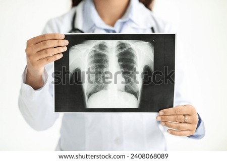 Unrecognizable woman doctor wearing white medical coat showing patient CT scan. Radiologist holding xray image in her hands, white studio background. Checkup, health care concept