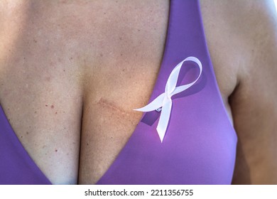 Unrecognizable Woman Shows Breast Cancer Scar.
Breast Cancer Awareness Day.
Anonymous Woman With Pink Ribbon Symbol. Breast Cancer Awareness Day Concept.