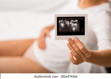 Unrecognizing Woman With Abdominal Pain Holds The Results Of Ultrasound Examination Of The Uterus And Ovaries. Diagnosis Of Diseases Uterus And Ovaries, Endometriosis, Ovarian Cysts